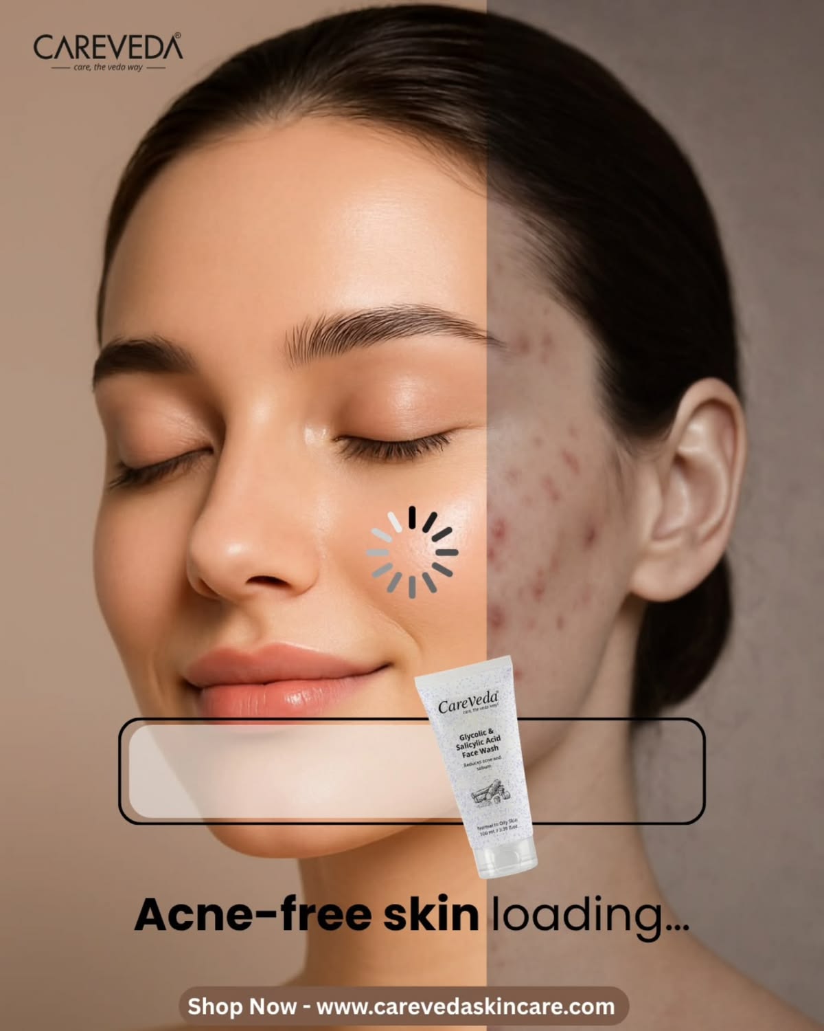 Acne Before & After Loading Skincare Ad